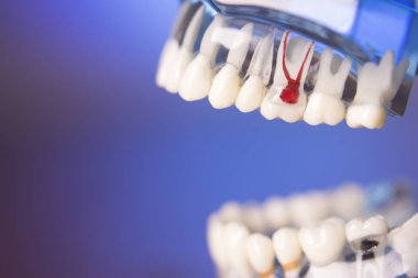 Takma diş diş hekimliği öğrencileri için