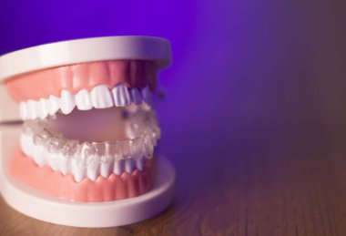 Takma diş şeffaf Ortodonti ile