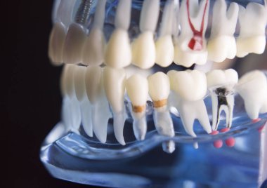 Takma diş diş hekimliği öğrencileri için