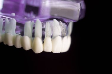 Takma diş diş hekimliği öğrencileri için
