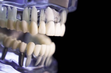 Takma diş diş hekimliği öğrencileri için