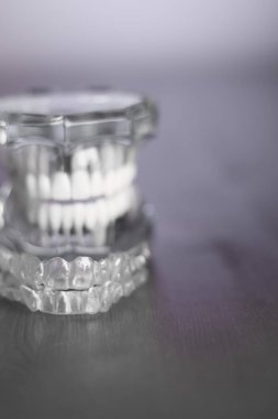 Diş ortodontik görünmez diş düzeltme