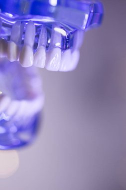 Takma diş diş hekimliği öğrencileri için