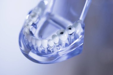 Takma diş diş hekimliği öğrencileri için