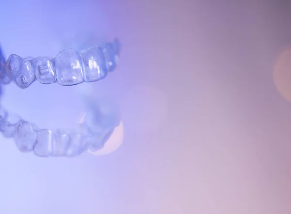 Виправлення зубів в стоматологічному ортодонті — стокове фото