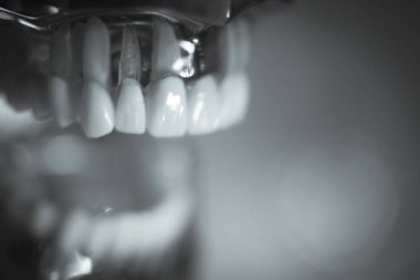 Takma diş diş hekimliği öğrencileri için