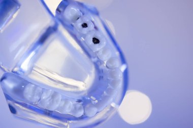 Takma diş diş hekimliği öğrencileri için