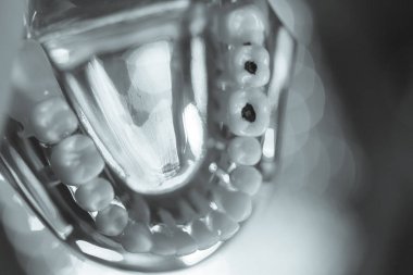 Takma diş diş hekimliği öğrencileri için