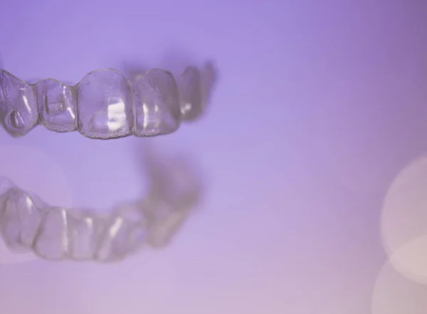 Odontologia ortodôntica dentes invisíveis correção — Fotografia de Stock