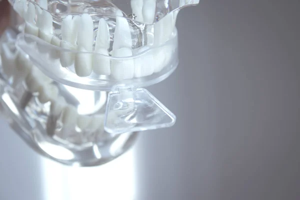 Foremki silikonowe, umieszczone na fałszywych zębów — Zdjęcie stockowe