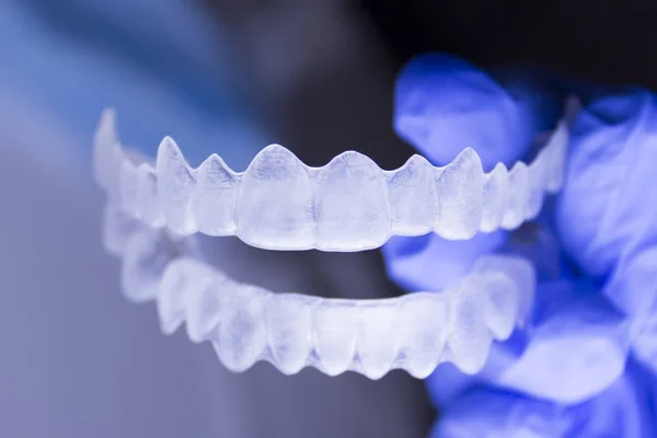 Kieferorthopädie in der Hand des Zahnarztes — Stockfoto