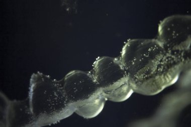 Görünmez diş Ortodonti temizlik kaplı