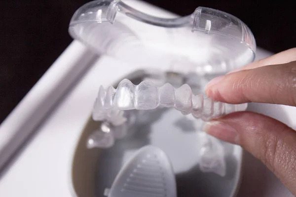Gros plan de l'orthodontie invisible — Photo