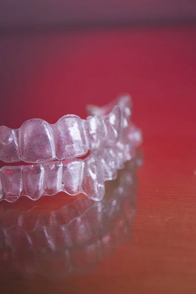 Orthodontie dentaire en plastique — Photo