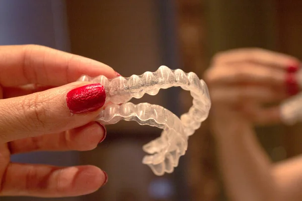 Ortodontia para corrigir o alinhamento dos dentes — Fotografia de Stock
