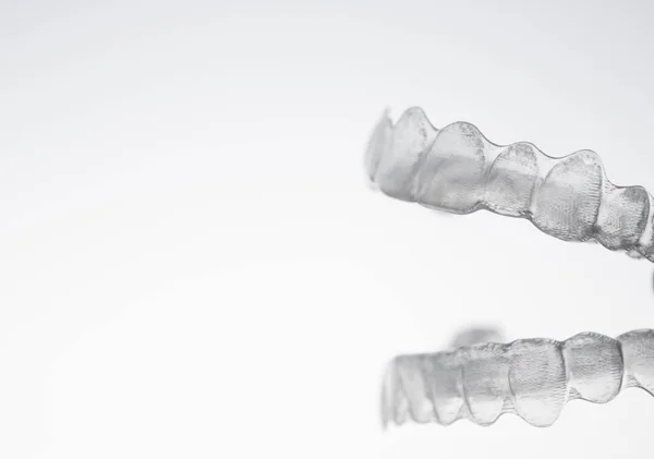Ortodontia para corrigir o alinhamento dos dentes — Fotografia de Stock