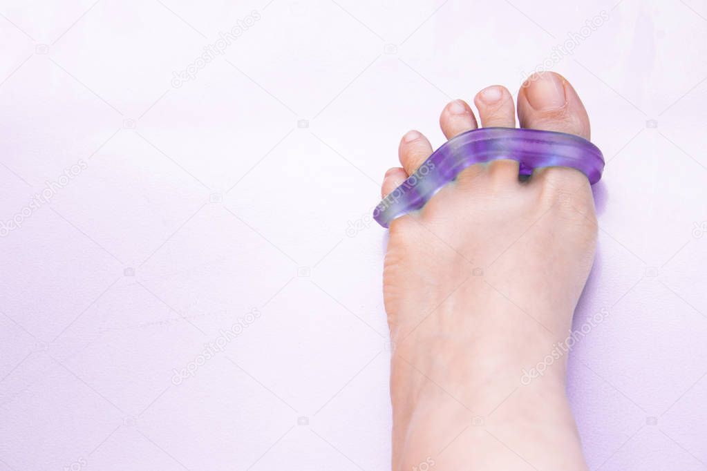 Foot of woman with silicone prosthesis to separate the toes