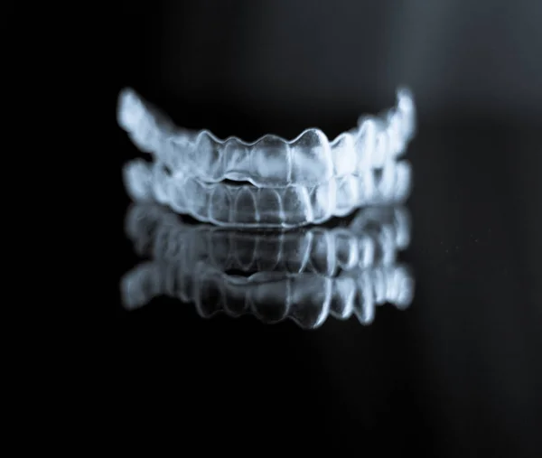 Αόρατη ορθοδοντική οδοντιατρική — Φωτογραφία Αρχείου