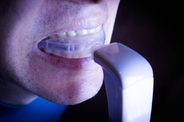 Diş Ortodonti için vibratör