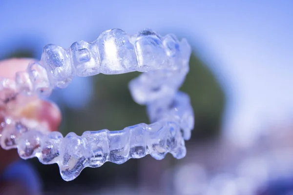 Apparecchi dentali invisibili tenuti dalla mano della donna — Foto Stock