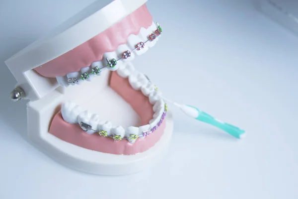 Модель Зубного Ряду Металевою Ортодонтією Немає Людей — стокове фото