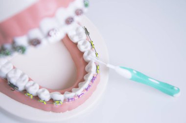 Metal ortodontikli protez. Kimse yok.