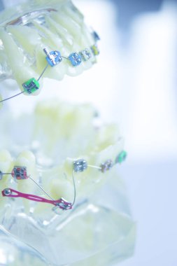 Metal ortodontikli protez. Kimse yok.