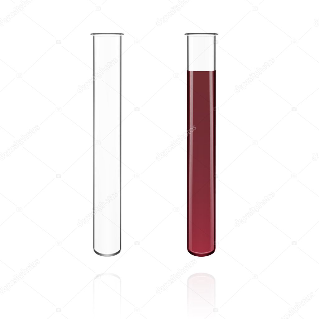 Test Tubes Filled With Blood