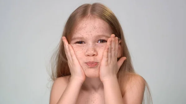 Little Girl with freckles holds hands her cheeks — ストック写真