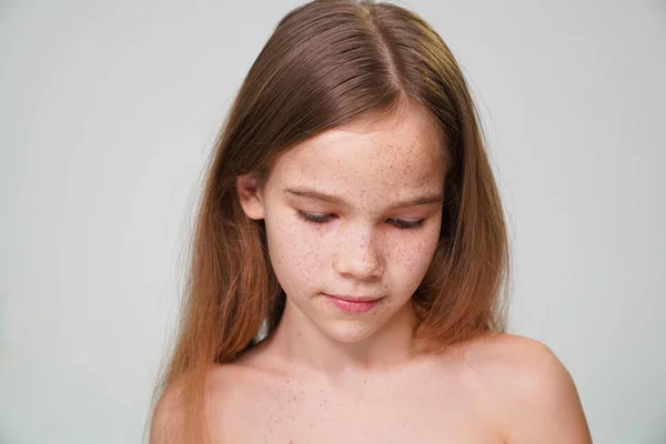 Tonåring flicka med fräknar rött hår täcker ansikte hand — Stockfoto