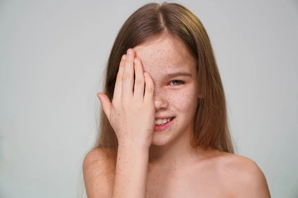 Tonåring flicka med fräknar rött hår täcker ansikte hand — Stockfoto