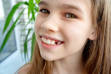 Çocuk dişlerinin önünde yetişkin dişleri çıkıyor.