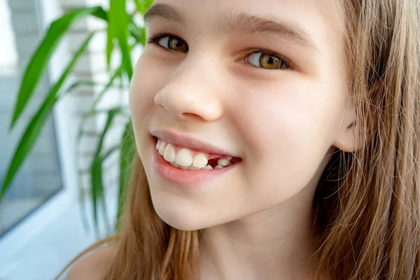 Dentes adultos que vêm na frente de dentes de bebê criança — Fotografia de Stock
