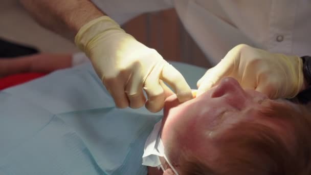 Manos dentista probar en el paciente de prótesis dentales — Vídeo de stock