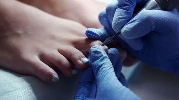 Toes nails are being polished by a milling cutter — Stock Video