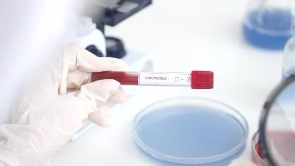 Científico está examinando la muestra de coronavirus en un laboratorio — Vídeo de stock