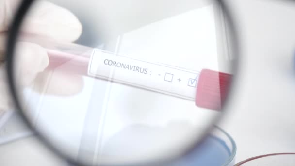 O cientista está a examinar uma amostra de coronavírus num laboratório. — Vídeo de Stock