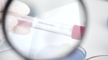 Scientist is examining coronavirus sample in a laboratory