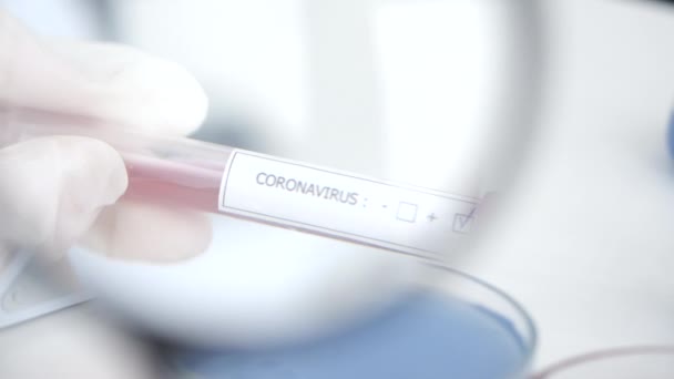 Científico está examinando la muestra de coronavirus en un laboratorio — Vídeo de stock