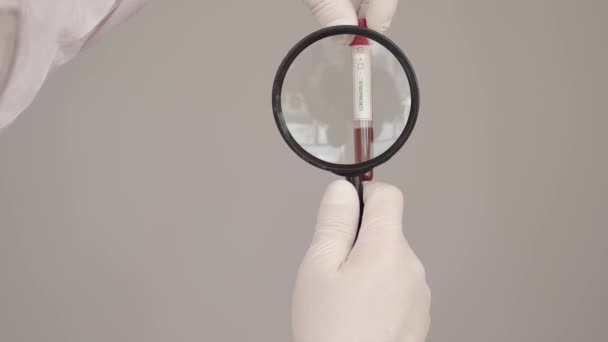 Científico masculino está examinando un análisis de sangre con una lupa — Vídeos de Stock