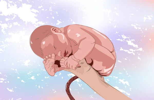 Realistické novorozeně v nemocnici s pupeční šňůrou. Právě jsem se narodil, první den, narození muže. Lékařský plakát nebo pohled na Den matek. Vektor — Stockový vektor