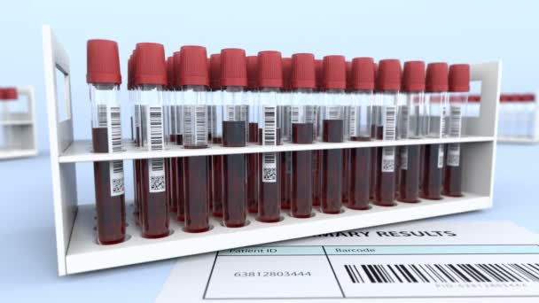 Δοκιμαστικοί σωλήνες δείγματος αίματος σε εφεδρικό εργαστήριο — Αρχείο Βίντεο