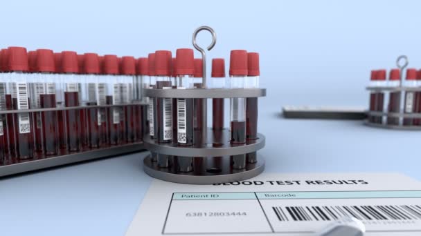 Тестові трубки зі зразком крові в репараційній лабораторії — стокове відео