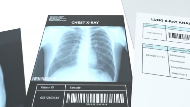 Рентгенолог проверяет рентгеновские снимки и делает заключение — стоковое видео