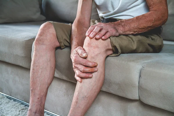Dor nas pernas e joelhos de um idoso seniorv — Fotografia de Stock