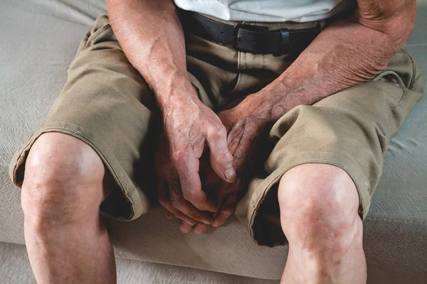 Hands on legs of an elderly man — Stock Photo, Image