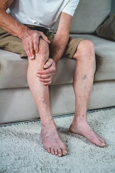 Dor nas pernas e joelhos de um idoso sênior — Fotografia de Stock