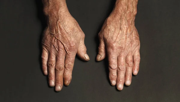 Faltige Hände eines älteren Mannes auf einem Tisch in Großaufnahme auf einem schwarzen — Stockfoto