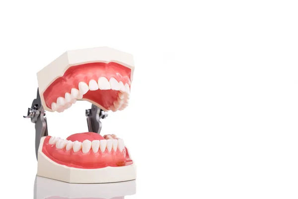 Modelo de dientes ortodóncicos del dentista con enfoque en los dientes inferiores — Foto de Stock