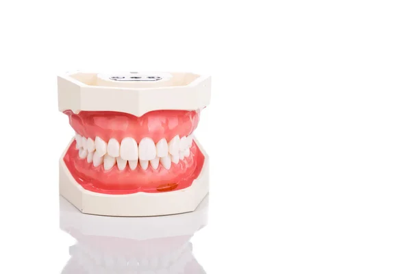 Dentist orthodontic teeth model with jaw closed — Stock Photo, Image